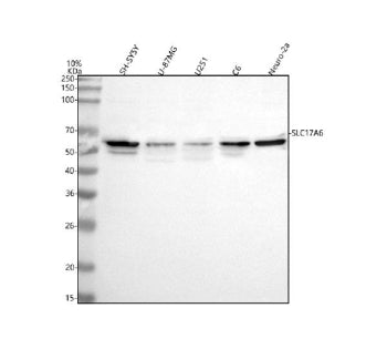 Western blot analysis of VGLUT2/SLC17A6 using anti-SLC17A6 antibody. Lane 1: human SH-SY5Y whole cell lysates, Lane 2: human U-87MG whole cell lysates, Lane 3: human U251 whole cell lysates, Lane 4: rat C6 whole cell lysates, Lane 5: mouse Neuro-2a whole cell lysates. After electrophoresis, proteins were transferred to a nitrocellulose membrane at 150 mA for 50-90 min. Blocked the membrane with 5% non-fat milk/TBS for 1.5 hour at RT.