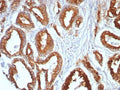 IHC staining of FFPE human prostate tissue with CD107a antibody (clone LAMP1/7456). HIER: boil tissue sections in pH 9 10mM Tris with 1mM EDTA for 20 min and allow to cool before testing.