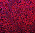 Immunofluorescent staining of FFPE human testis cancer tissue with DYNLT1 antibody (red) and DAPI nuclear stain (blue). HIER: steam section in pH8 EDTA buffer for 20 min.