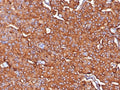 IHC staining of FFPE human adrenal tissue with Synaptophysin antibody (clone SYP/7976R). HIER: boil tissue sections in pH 9 10mM Tris with 1mM EDTA for 20 min and allow to cool before testing.