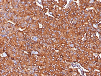 IHC staining of FFPE human adrenal tissue with Synaptophysin antibody (clone SYP/7976R). HIER: boil tissue sections in pH 9 10mM Tris with 1mM EDTA for 20 min and allow to cool before testing.