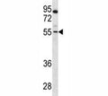 PAX7 antibody western blot analysis in CEM lysate. Expected molecular weight: 55-57 kDa.