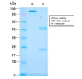 SDS-PAGE analysis of purified, BSA-free recombinant CLIP antibody (clone rCLIP/1418) as confirmation of integrity and purity.