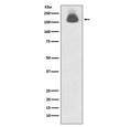 Western blot testing of lysate from human A431 cells treated with EGF with phospho-EGFR antibody. Expected molecular weight: 134-170 kDa depending on glycosylation level.