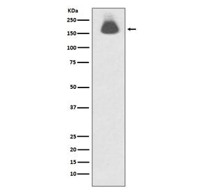 Western blot testing of lysate from human A431 cells treated with EGF with phospho-EGFR antibody. Expected molecular weight: 134-170 kDa depending on glycosylation level.
