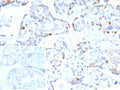 IHC staining of FFPE human bladder tissue with p57Kip2 antibody. Strong nuclear staining using rKIP2/7238 mAb at 2ug/ml. Inset: PBS used in place of primary Ab (secondary Ab negative control). HIER: boil tissue sections in pH 9 10mM Tris with 1mM EDTA for 20 min and allow to cool before testing.