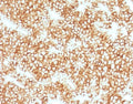 IHC testing of FFPE human parathyroid gland stained with recombinant Parathyroid Hormone antibody (clone PRTM1-1R). Required HIER: steam sections in pH 9 10mM Tris with 1mM EDTA for 10-20 min.