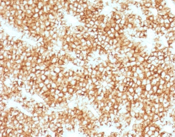 IHC testing of FFPE human parathyroid gland stained with recombinant Parathyroid Hormone antibody (clone PRTM1-1R). Required HIER: steam sections in pH 9 10mM Tris with 1mM EDTA for 10-20 min.