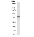 Western blot testing of human brain lysate with NPY5R antibody at 0.3ug/ml. Predicted/observed molecular weight: ~51kDa.