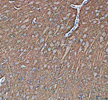 IHC staining of FFPE pig brain tissue with Synapsin II antibody, HRP-secondary and DAB substrate. HIER: boil tissue sections in pH8 EDTA for 20 min and allow to cool before testing.