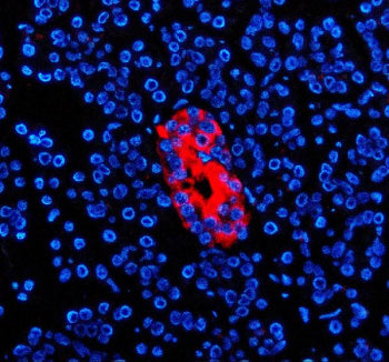Immunofluorescent staining of ZNT8/SLC30A using anti-SLC30A antibody (red). ZNT8/SLC30A was detected in a paraffin-embedded section of human pancreas tissue. Heat mediated antigen retrieval was performed in EDTA buffer (pH 8.0, epitope retrieval solution). The tissue section was blocked with 10% goat serum. The tissue section was then incubated with 5 ug/ml rabbit anti-SLC30A antibody overnight at 4oC.