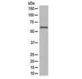 Western blot testing of human JAR cell lysate with NOX4 antibody at 0.5ug/ml. Expected molecular weight: ~65 kDa, 75-80 kDa.