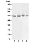 Western blot testing of 1) rat muscle, 2) human COLO320, 3) human 22RV1 and 4) human PANC lysate with ABCB10 antibody at 0.5ug/ml. Expected molecular weight: ~79 kDa (full), ~65 kDa (cleaved mitochondrial targeting sequence (amino acids 1-105)).