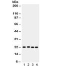 Western blot testing of 1) rat PC12, human 2) SW620, 3) HeLa and 4) MCF7 lysate with SOCS2 antibody. Expected/observed molecular weight: 22 kDa.