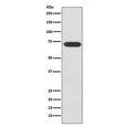 Western blot testing of human HeLa cell lysate with ATF2 antibody. Expected molecular weight: 65-70 kDa.