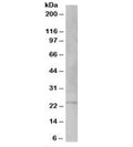 Western blot testing of human testis lysate with VSP28 antibody at 1ug/ml. Predicted molecular weight: ~25kDa.