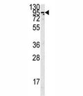 Western blot analysis of the Angiotensin-converting enzyme 2 antibody in K562 lysate. Predicted molecular weight: 90-100 kDa.