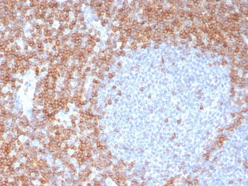 IHC staining of FFPE human tonsil tissue with CD7 antibody (clone CD7/8118R). HIER: boil tissue sections in pH 9 10mM Tris with 1mM EDTA for 20 min and allow to cool before testing.