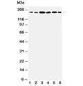 Western blot testing of Laminin gamma 1 antibody and Lane 1: rat kidney; 2: rat lung; 3: U87; 4: SMMC-7721; 5: HeLa; 6: SKOV3 cell lysate. Expected molecular weight: 174-200 kDa.