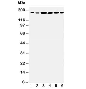 Western blot testing of Laminin gamma 1 antibody and Lane 1: rat kidney; 2: rat lung; 3: U87; 4: SMMC-7721; 5: HeLa; 6: SKOV3 cell lysate. Expected molecular weight: 174-200 kDa.