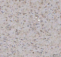 IHC staining of FFPE mouse brain tissue with MAP1S antibody. HIER: boil tissue sections in pH8 EDTA for 20 min and allow to cool before testing.