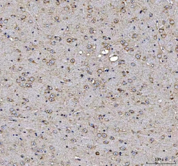 IHC staining of FFPE mouse brain tissue with MAP1S antibody. HIER: boil tissue sections in pH8 EDTA for 20 min and allow to cool before testing.