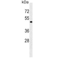 Western blot testing of human K562 cell lysate with PNPLA3 antibody. Predicted molecular weight ~53 kDa.