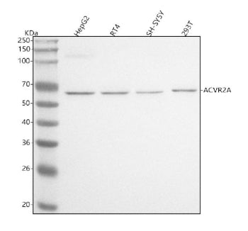 Western blot analysis of ACVR2A using anti-ACVR2A antibody. Lane 1: human HepG2 whole cell lysates, Lane 2: human RT4 whole cell lysates, Lane 3: human SH-SY5Y whole cell lysates, Lane 4: human 293T whole cell lysates. After electrophoresis, proteins were transferred to a nitrocellulose membrane at 150 mA for 50-90 min. Blocked the membrane with 5% non-fat milk/TBS for 1.5 hour at RT.