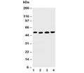 Western blot testing of TRAIL R2 antibody and Lane 1: HeLa; 2: MM231; 3: SGC; 4: HT1080 cell lysate