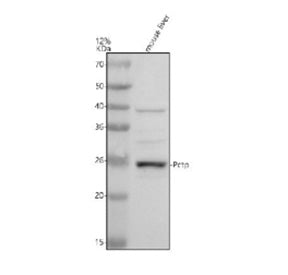 Western blot analysis of PCTP using anti-PCTP antibody. Electrophoresis was performed on a 12% SDS-PAGE gel at 80V (Stacking gel) / 120V (Resolving gel) for 2 hours. Lane 1: mouse liver tissue lysates. After electrophoresis, proteins were transferred to a nitrocellulose membrane at 150 mA for 50-90 min. Blocked the membrane with 5% non-fat milk/TBS for 1.5 hour at RT.