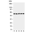 Western blot testing of HYAL2 antibody and Lane 1: HeLa; 2: SMMC-7721; 3: COLO320; 4: MCF-7; 5: HT1080 cell lysate