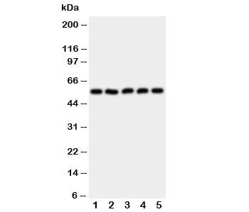 Western blot testing of HYAL2 antibody and Lane 1: HeLa; 2: SMMC-7721; 3: COLO320; 4: MCF-7; 5: HT1080 cell lysate