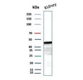 Western blot testing of human kidney tissue lysate with IDH1-R132G antibody (clone IDH1.R132G/13054R). Predicted molecular weight ~47 kDa.