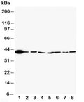 Western blot testing of ERK2 antibody and Lane 1: rat brain; 2: rat lung; 3: rat placenta; 4: HT1080; 5: HeLa; 6: MM231; 7: Raji; 8: COLO320 cell lysate. Predicted/observed molecular weight: ~41kDa.