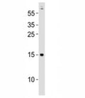 Western blot testing of Gabarapa antibody at 1:500 dilution + zebrafish lysate; Predicted molecular weight : 14 kDa.