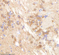 IHC staining of FFPE zebrafish brain tissue with Pafah1b1 antibody, HRP-labeled secondary and DAB substrate. HIER: boil tissue sections in pH8 EDTA for 20 min and allow to cool before testing.