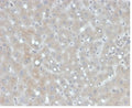 IHC staining of FFPE human liver tissue with Apolipoprotein B antibody (clone APOB/4335). HIER: boil tissue sections in pH 9 10mM Tris with 1mM EDTA for 20 min and allow to cool before testing.