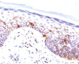 IHC testing of FFPE human skin stained with CD1a antibody (clone CLDA1a). Staining of formalin-fixed tissues requires boiling tissue sections in pH 9 10mM Tris with 1mM EDTA for 10-20 min followed by cooling at RT for 20 min.