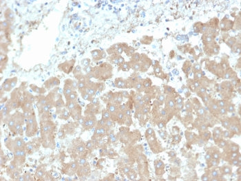 IHC staining of human liver tissue with Leptin Receptor antibody (clone LEPR/4301). HIER: boil tissue sections in pH 9 10mM Tris with 1mM EDTA for 20 min and allow to cool before testing.