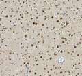IHC staining of FFPE human brain tissue with RPL19 antibody, HRP-secondary and DAB substrate. HIER: boil tissue sections in pH8 EDTA for 20 min and allow to cool before testing.