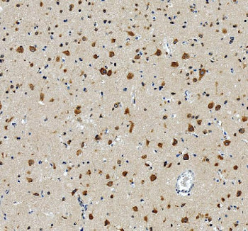 IHC staining of FFPE human brain tissue with RPL19 antibody, HRP-secondary and DAB substrate. HIER: boil tissue sections in pH8 EDTA for 20 min and allow to cool before testing.