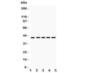 Western blot testing of HOXA10 antibody and Lane 1: rat kidney; 2: human placenta; 3: (h) HeLa; 4: (h) SW620; 5: mouse HEPA lysate. Predicted molecular weight: ~42kDa.