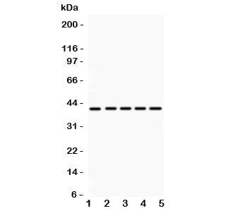 Western blot testing of HOXA10 antibody and Lane 1: rat kidney; 2: human placenta; 3: (h) HeLa; 4: (h) SW620; 5: mouse HEPA lysate. Predicted molecular weight: ~42kDa.