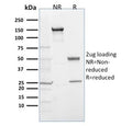 SDS-PAGE analysis of purified, BSA-free EGLN1 antibody (clone 366G/76/3) as confirmation of integrity and purity.