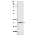 Western blot testing of human Jurkat antibody with Ferritin antibody. Predicted molecular weight ~21 kDa.