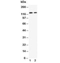 Western blot testing of P-Cadherin antibody and Lane 1: recombinant human protein 10ng; 2: 5ng. Expected molecular weight: ~91 (unmodified), 100~130 kDa (glycosylated).
