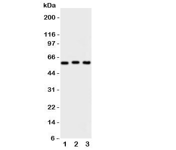 Western blot testing of PKM2 antibody and Lane 1: HeLa; 2: MCF-7; 3: A549 cell lysate. Predicted molecular weight ~58 KDa.