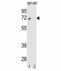 Western blot analysis of ER antibody pre-incubated without (Lane 1) and with (2) blocking peptide in K562 lysate. Predicted molecular weight: 65-70 kDa.