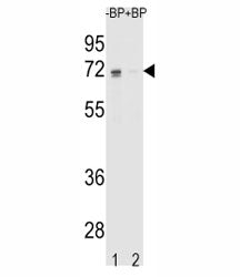 Western blot analysis of ER antibody pre-incubated without (Lane 1) and with (2) blocking peptide in K562 lysate. Predicted molecular weight: 65-70 kDa.