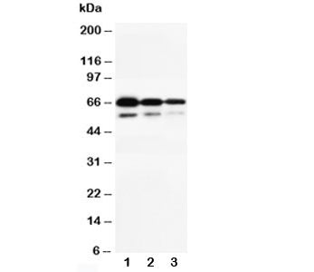 Western blot testing of CD34 antibody and Lane 1: Recombinant human CD34 protein 10ng; 2: 5ng; 3: 2.5ng